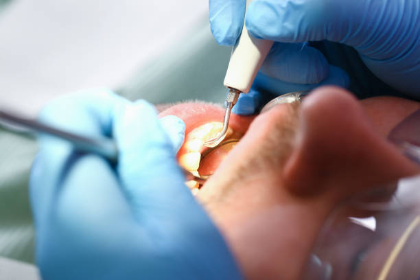 Best Dentist for Tooth Abscess  in Robbinsdale, MN